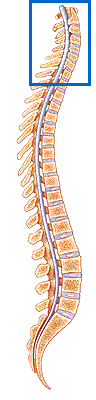 Cervical Stenosis