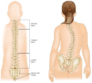 Idiopathic Scoliosis in Children and Adolescents