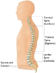 Kyphosis