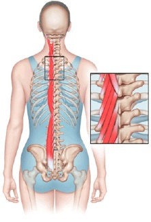 Low Back Pain in Athletes 