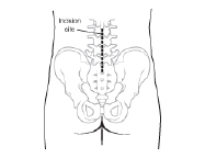 Spinal Fusion Glossary: Spine Basics