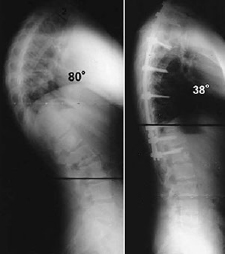 Preoperative x-ray-Surgical Procedure