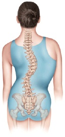 Scoliosis