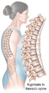 Thoracic Spine